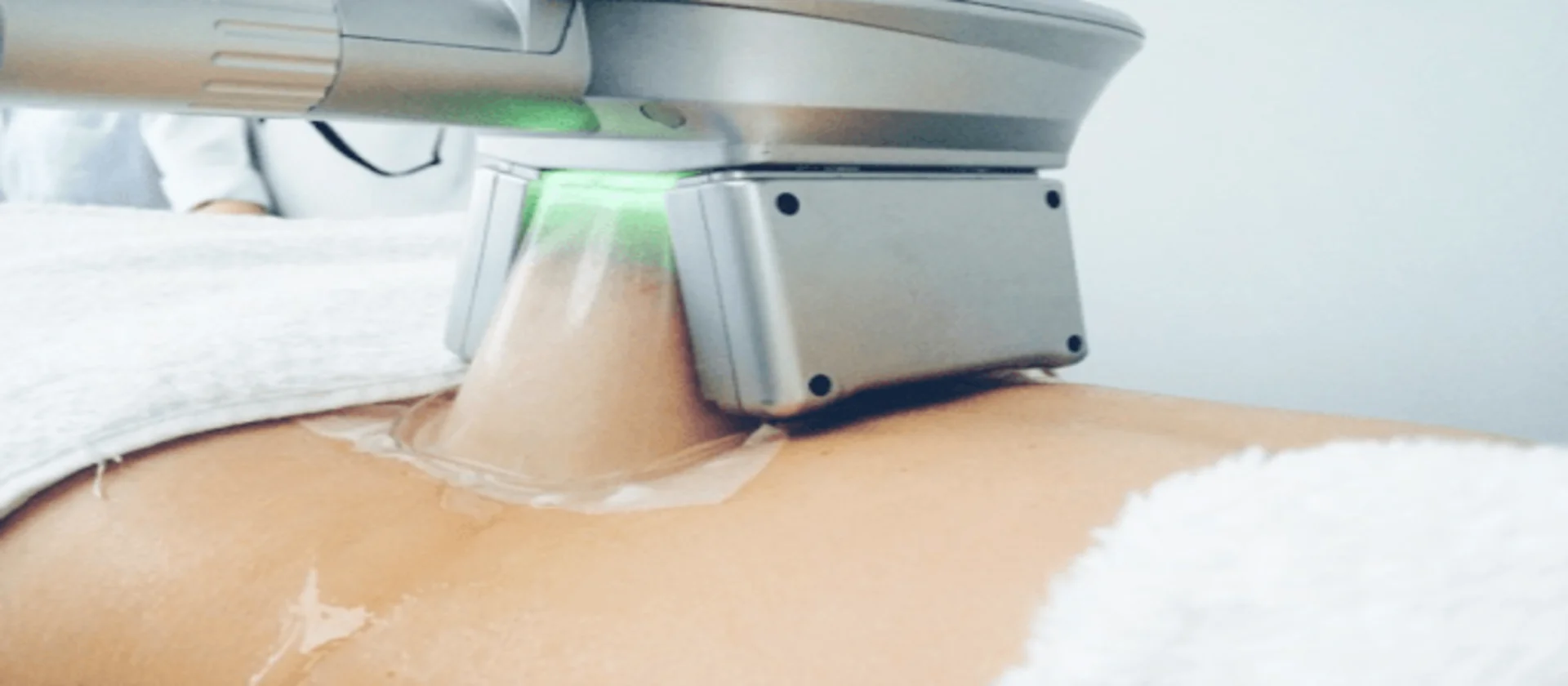 Criolipólisis Plana